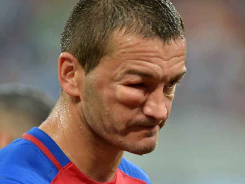 Bojan Golubovic cu ochiul tumefiat